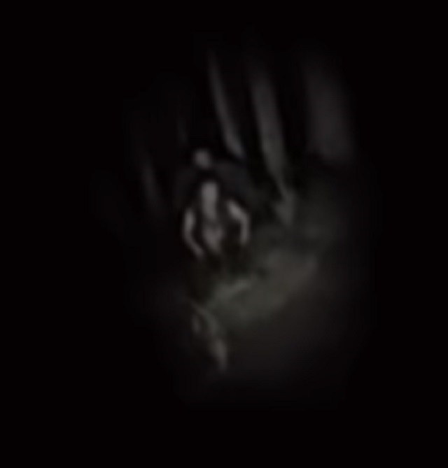 Faceless Freaks Found Frolicking In The Forest Strange Before It S News