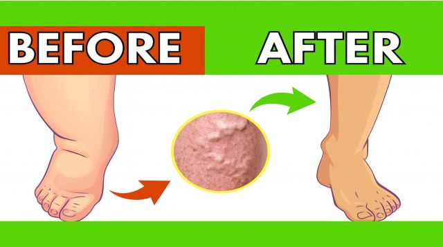 Top 5 Beverages to IMMEDIATELY Enhance Leg Circulation & Blood Flow
