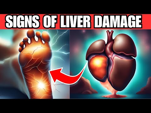 LIVER is dying! 12 weird signs of LIVER DAMAGE you must know