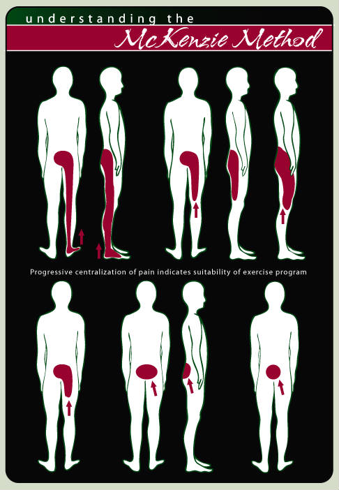 Lower Back Pain Shooting Down Front Of Thigh