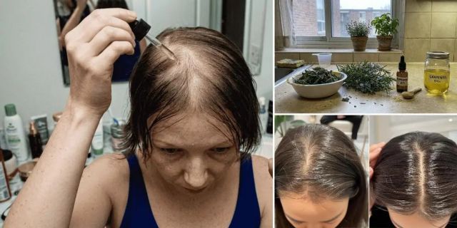 Don’t Try This Hair Treatment If You’re Not Prepared For Extreme Hair Growth