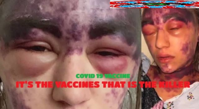 Murder Most Horrid! COVID 19 Vaccine Murder!