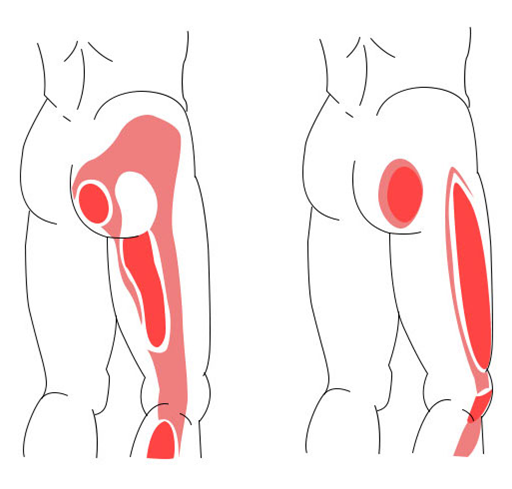 lower-back-buttock-pain-the-muscles-at-the-source-health-before