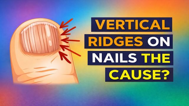 The Real Causes of Vertical Ridges on Your Nails | Health | Before It's ...