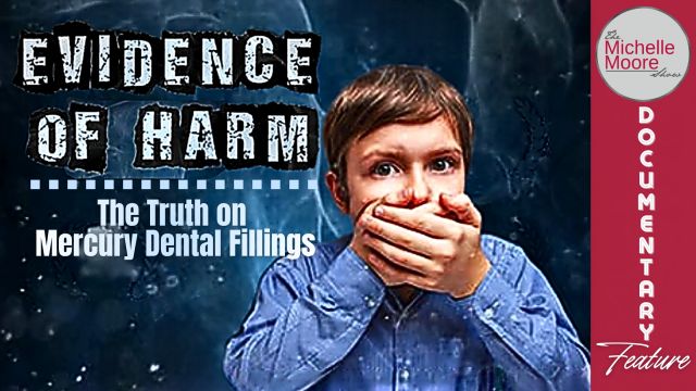 Mercury in Dental Fillings—Documentary Exposes the Truth About the Health Effects (VIDEO)